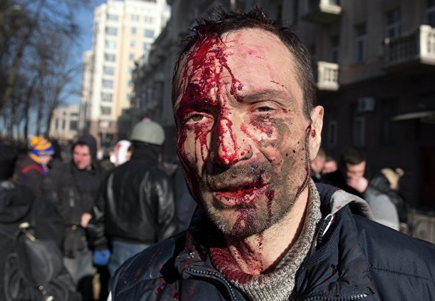 Пострадавший полицейский в ходе беспорядков в Киеве Пострадавший полицейский в ходе беспорядков в Киеве