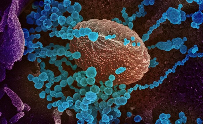 Изображение нового коронавируса, появляющегося на поверхности клеток, культивируемых в лаборатории