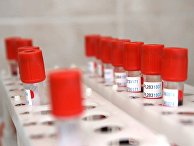 В России завершился первый этап испытания вакцины против COVID-19 В России завершился первый этап испытания вакцины против COVID-19