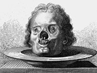 Череп женщины, страдавшей от сифилиса Череп женщины, страдавшей от сифилиса